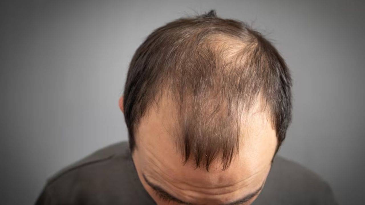 এক পাতাতেই টাক মাথায় গজাবে চুল, ত্বক হবে চকচকে! শুধু জেনে নিন উপায়