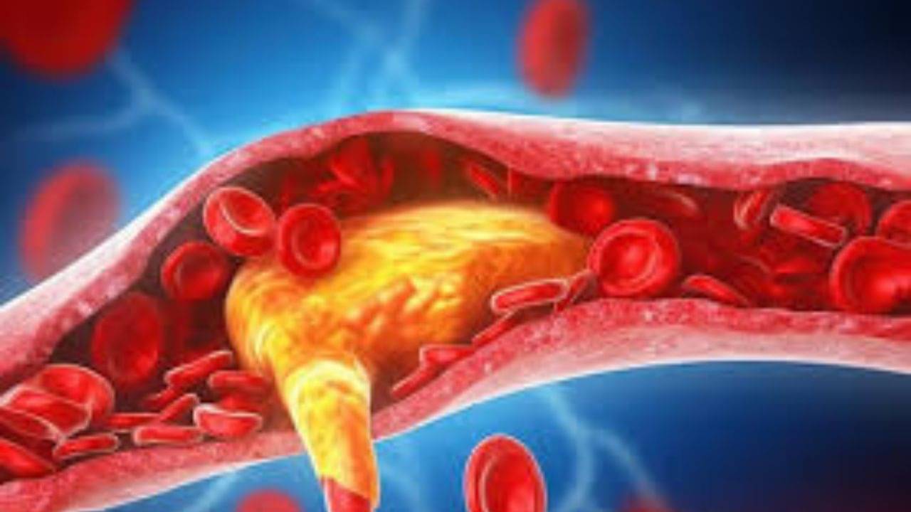 উপসর্গহীন এই রোগেই প্রতি বছর প্রাণ হারাচ্ছেন লক্ষ লক্ষ মানুষ, আপনার শরীরেও বাসা বাঁধেনি তো?