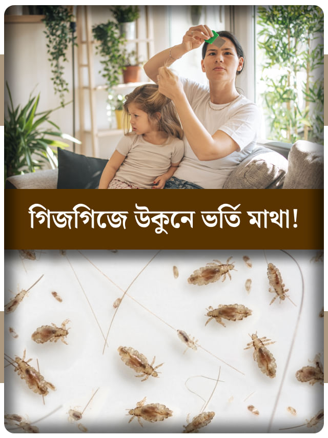 মাথায় গিজগিজ করছে উকুন? কোন উপায়ে মিলবে এই সমস্যা থেকে মুক্তি মাথায় গিজগিজ করছে উকুন? কোন উপায়ে মিলবে এই সমস্যা থেকে মুক্তি