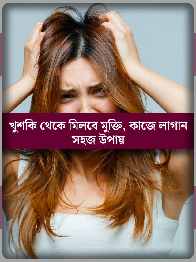 বর্ষায় খুশকির সমস্যায় নাজেহাল? রইল হাফডজন টোটকা, মিলিয়ে নিন যে কোনও একটা বর্ষায় খুশকির সমস্যায় নাজেহাল? রইল হাফডজন টোটকা, মিলিয়ে নিন যে কোনও একটা