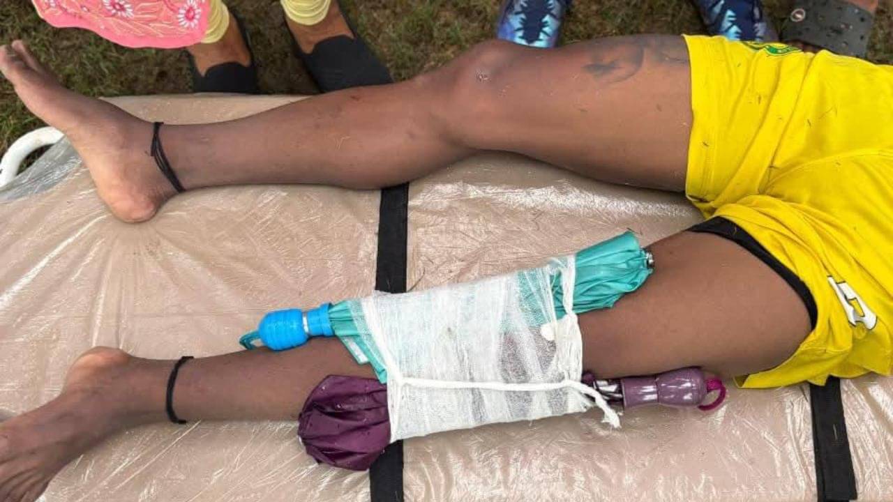 Kolkata Football: পায়ে মারাত্মক চোট, ছাতা দিয়ে ব্যান্ডেজ বাঁধা হল, হতবাক ময়দান!