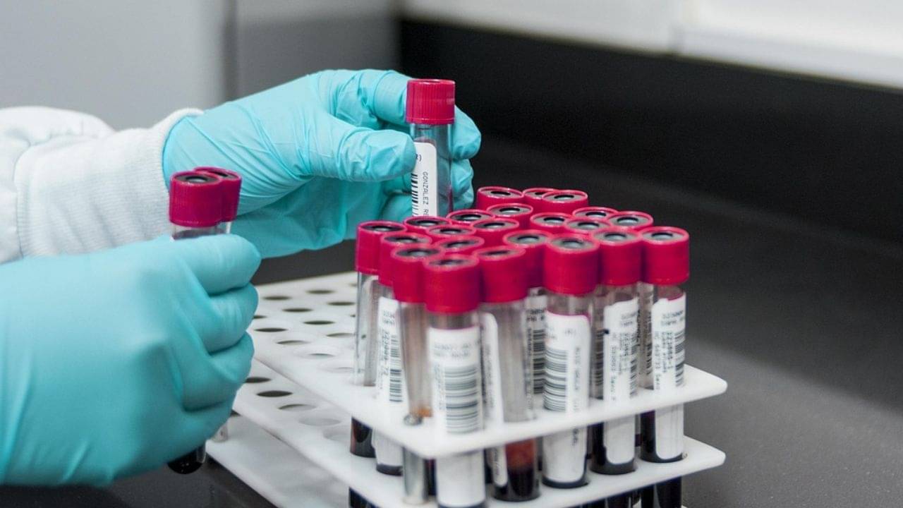 Blood Purification: রক্ত থেকে সকল নোংরা-আবর্জনা দূর করতে চান? রোজকার ৫ খাবারেই হবে সমস্যার সমাধান