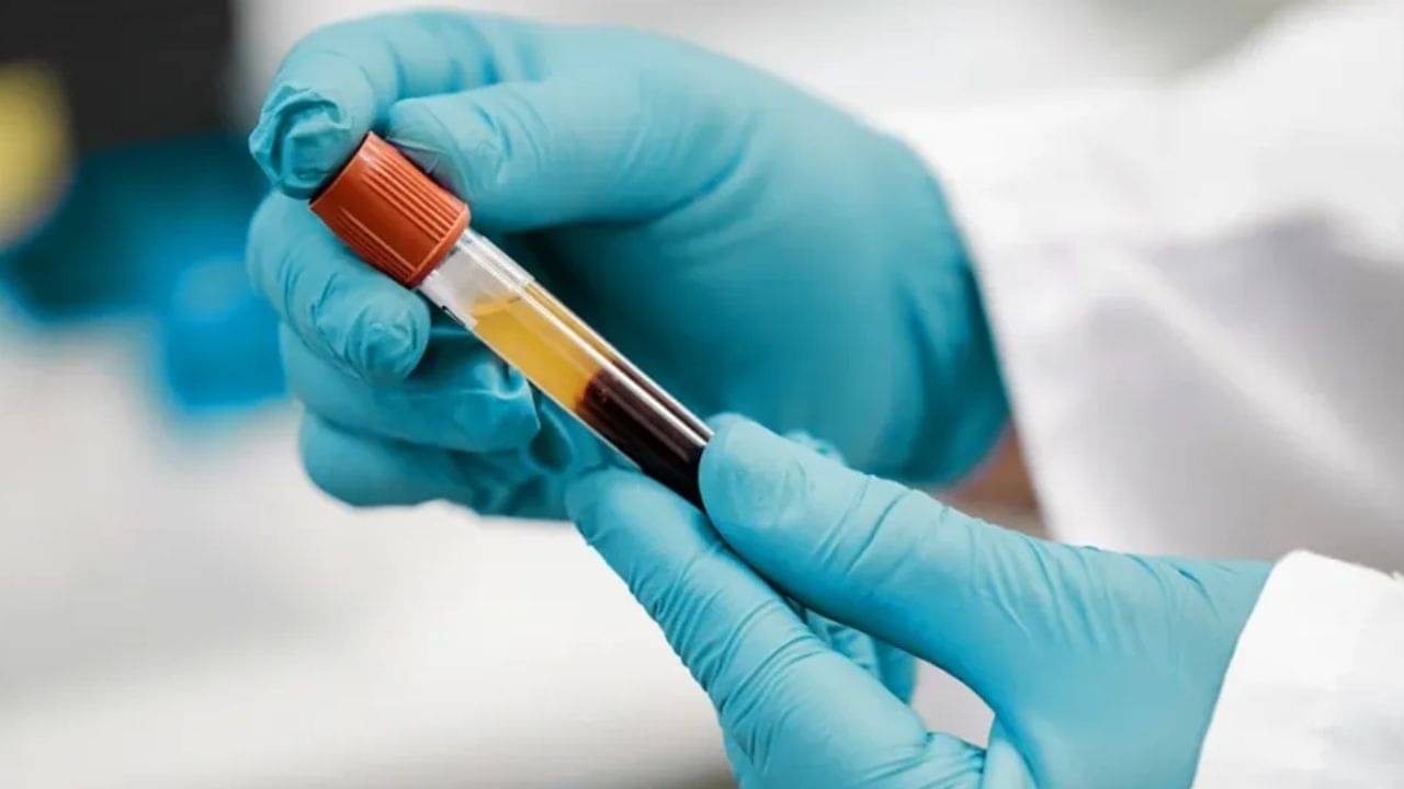 আপনার রক্ত পাতলা না ঘন? জেনে নেওয়ার কায়দা বলে দিলেন ডাক্তার