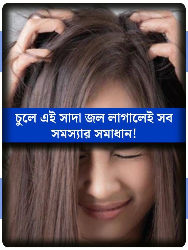 এই সাদা জলই পারে আপনার চুলের সব রকম সমস্যার সমাধান করতে! জানুন কীভাবে? এই সাদা জলই পারে আপনার চুলের সব রকম সমস্যার সমাধান করতে! জানুন কীভাবে?