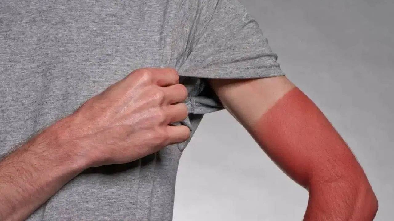 Tan Remove Tips: ট্যান পড়ে হাত কালো হয়ে গেছে? তাকে চকচকে করে তুলবেন কীভাবে?