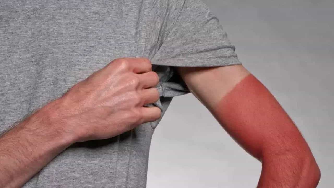 Tan Remove Tips: ট্যান পড়ে হাত কালো হয়ে গেছে? তাকে চকচকে করে তুলবেন কীভাবে? Tan Remove Tips: ট্যান পড়ে হাত কালো হয়ে গেছে? তাকে চকচকে করে তুলবেন কীভাবে?