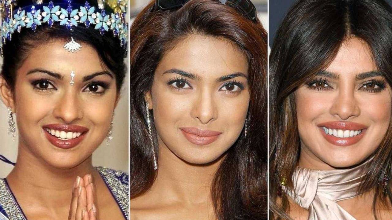 প্রিয়াঙ্কা চোপড়ার নাক সার্জারির ফসল, ফাঁস করলেন সুনীল দর্শন