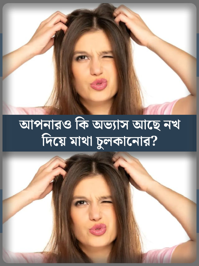 নখ দিয়ে মাখা চুলকান? অজান্তেই নিজের বড় ক্ষতি ডেকে আনছেন... নখ দিয়ে মাখা চুলকান? অজান্তেই নিজের বড় ক্ষতি ডেকে আনছেন...