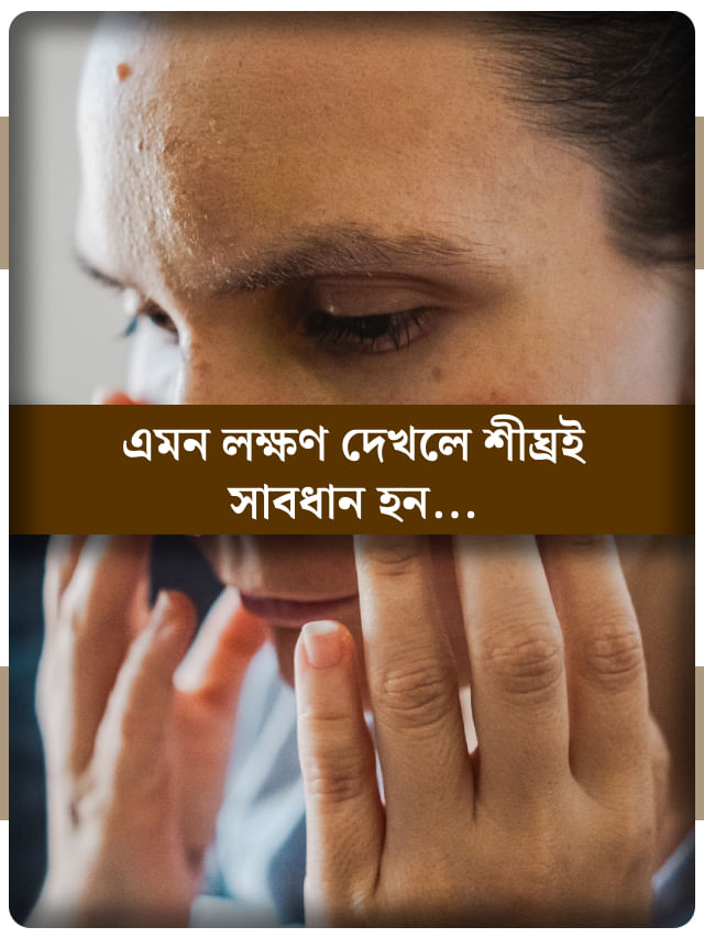 ঘুম থেকে উঠে দেখেন চোখ-মুখ ফোলা? বড় কোনও রোগের ইঙ্গিত নয় তো!