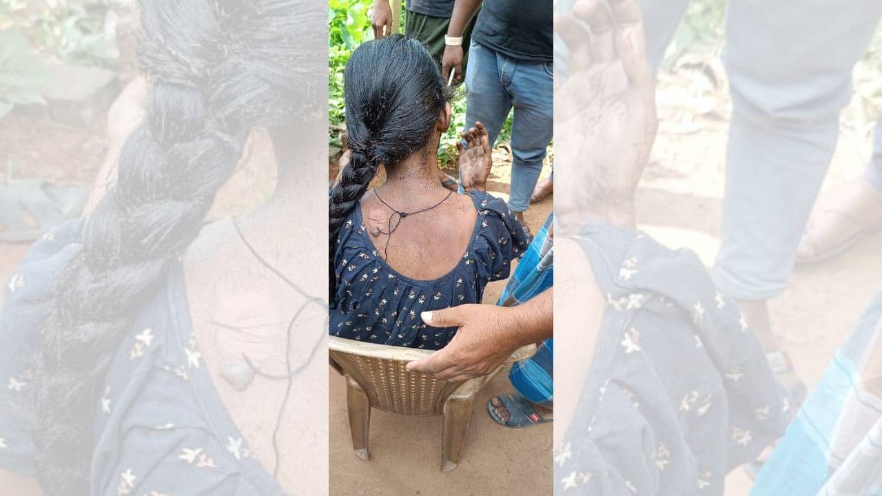 Puri: পুরীতে হাড়হিম ঘটনা, রাস্তার উপরই ১৫ বছরের কিশোরীকে জ্যান্ত জ্বালাল দুষ্কৃতীরা