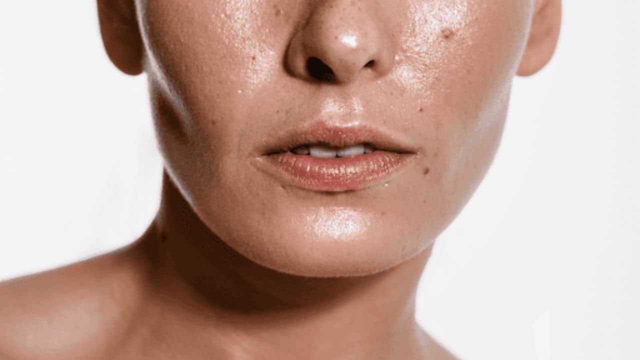 Oily Skin: মুখে কেন তেল হয়? কীভাবে পাবেন তৈলাক্ত ত্বক থেকে মুক্তি?