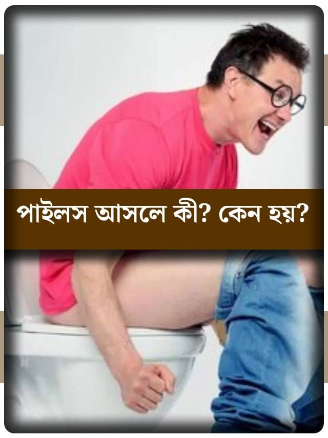 পাইলস আসলে কী, কেন হয়? ঠিক কোন কাজ করলে মেলে মুক্তি? পাইলস আসলে কী, কেন হয়? ঠিক কোন কাজ করলে মেলে মুক্তি?