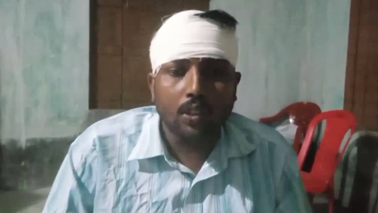 CPIM: পঞ্চায়েতে স্মারকলিপি দিতে যেতেই ঝাঁপিয়ে পড়লেন কয়েকজন, মাথা ফাটল বাম যুবনেতার