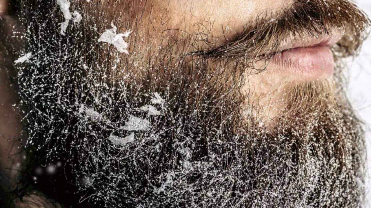 Beared Care Tips: সাধের দাঁড়িতে ভর্তি ড্যানড্রফ? কীভাবে মিলবে মুক্তি?