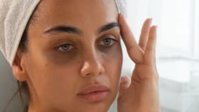 চোখের নীচে ঘন কালচে দাগের জন্য ভুগছেন আত্মবিশ্বাসের অভাবে? সারান এভাবে