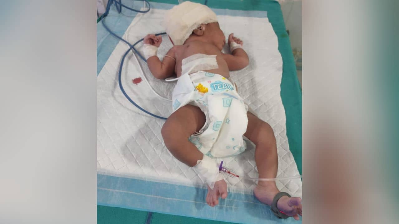 Cooch Behar: সিজার করতে গিয়ে গর্ভের সন্তানের মাথায় পড়ল সেলাই, শোরগোল দিনহাটা হাসপাতালে