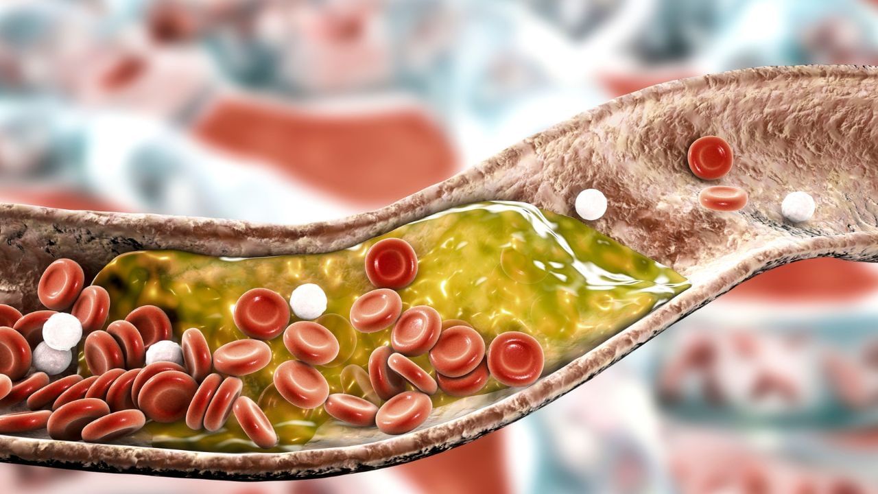 Cholesterol: লেজ তুলে পালাবে কোলেস্টেরল! যদি রোজ খেতে পারেন এই একটি ফল
