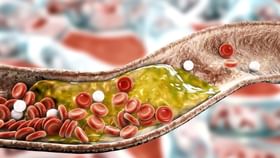 লেজ তুলে পালাবে কোলেস্টেরল! যদি রোজ খেতে পারেন এই একটি ফল