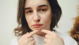 আচমকা মুখে উঁকি দিয়েছে পিম্পল? এই টোটকায় রাতারাতি সারান ব্রণ