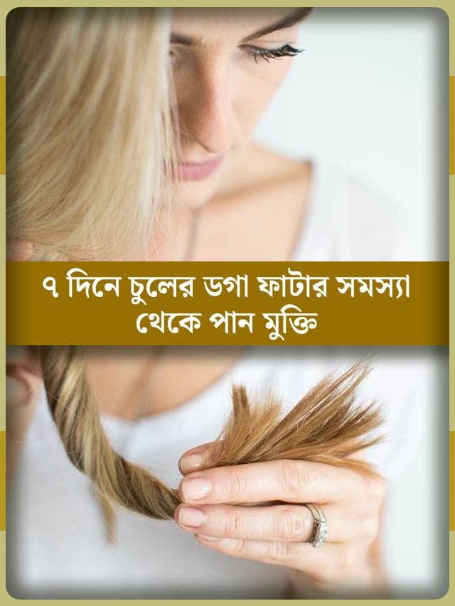 ডগা ফেটে চুল বাড়ছেই না? এক সপ্তাহেই সারিয়ে তুলুন স্প্লিট এন্ড হেয়ার ডগা ফেটে চুল বাড়ছেই না? এক সপ্তাহেই সারিয়ে তুলুন স্প্লিট এন্ড হেয়ার