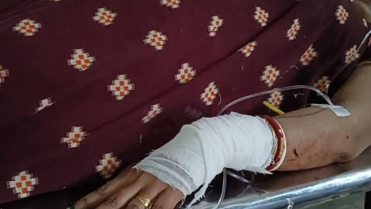 Malda TMC: হাঁসুয়া দিয়ে কোপ মেরে বাঁ হাত কেটে নিয়ে যাওয়ার চেষ্টা করেছিল! বিস্ফোরক অভিযোগ তৃণমূলকর্মীর