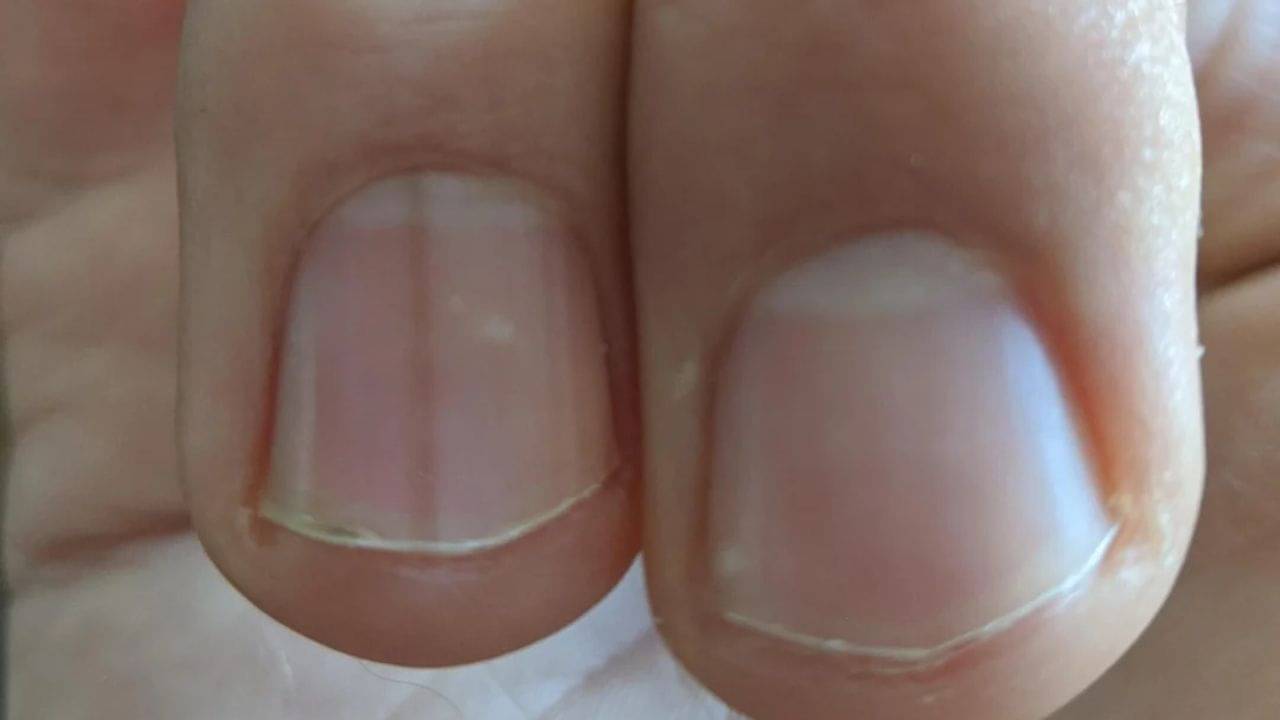 Nails: আপনার শরীরে কীসের ঘাটতি রয়েছে? কেবল নখ দেখে বলে দেওয়া সম্ভব! জানুন ট্রিকস