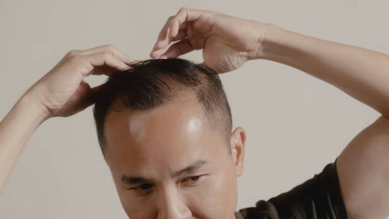 টাক মাথাতেও গজাবে চুল, ধুতরো ফুলের এমন ব্যবহার জানলে চমকে যাবেন