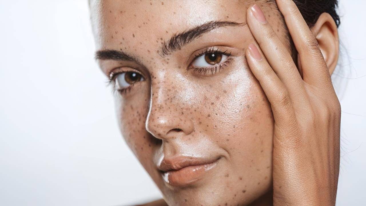 Pigmentation: পিগমেন্টেশনের জ্বালায় মুখ লুকোচ্ছেন? রইল তা দূর করার ঘরোয়া উপায়