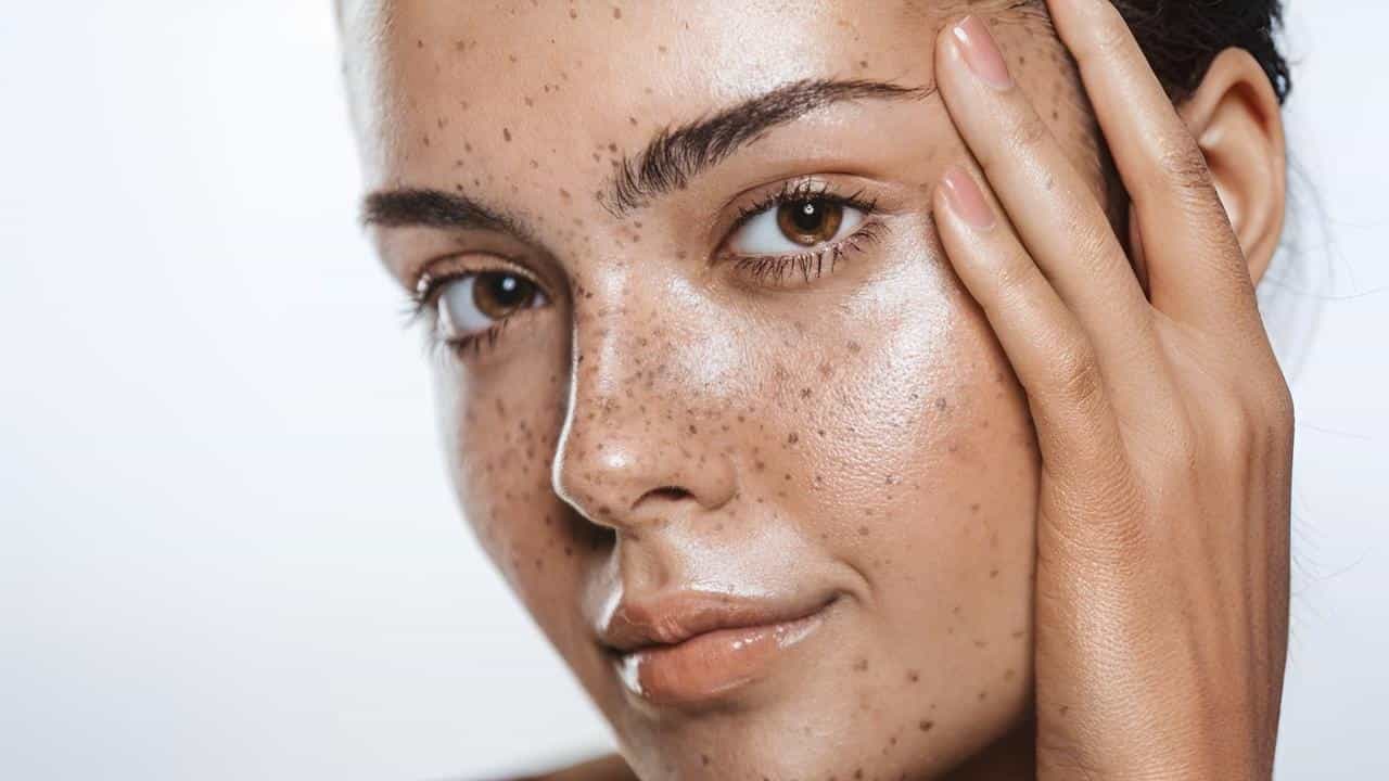 Pigmentation: পিগমেন্টেশনের জ্বালায় মুখ লুকোচ্ছেন? রইল তা দূর করার ঘরোয়া উপায় Pigmentation: পিগমেন্টেশনের জ্বালায় মুখ লুকোচ্ছেন? রইল তা দূর করার ঘরোয়া উপায়