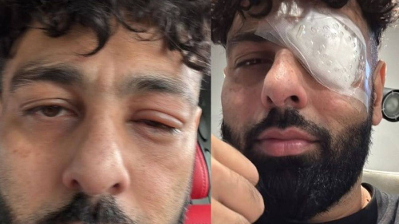 চোখে ব্যান্ডেজ নিয়ে ছবি পোস্ট বাদশার! হঠাৎ কী হল গায়কের?