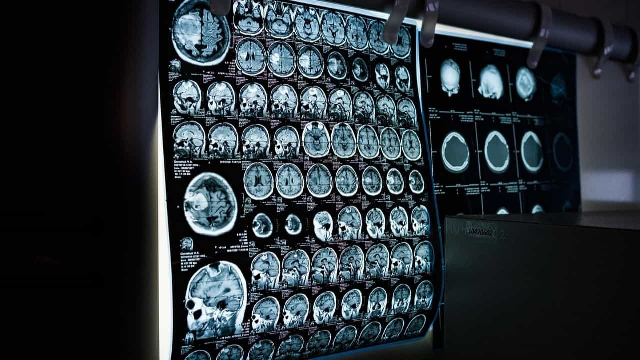 Brain Eating Amoeba: ব্রেন কুরে কুরে খাচ্ছে অ্যামিবা, ইতিমধ্যেই ১৯ জনের মৃত্যু কেরলে, বাংলাতেও ছড়িয়ে পড়বে না তো? Brain Eating Amoeba: ব্রেন কুরে কুরে খাচ্ছে অ্যামিবা, ইতিমধ্যেই ১৯ জনের মৃত্যু কেরলে, বাংলাতেও ছড়িয়ে পড়বে না তো?