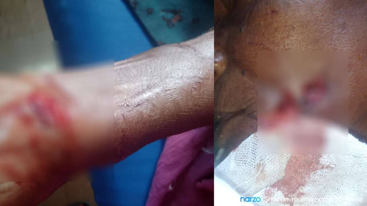 Leopard Attack: রাতের অন্ধকারে বৃদ্ধার টুঁটি চেপে ধরল চিতাবাঘ, বাঁচাতে গেলে জখম আরও ৩