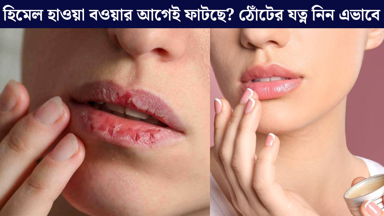 Lip Care: শীত আসার আগেই ঠোঁট ফাটছে? এখন থেকেই যত্ন শুরু করুন, পাবেন নরম গোলাপি ঠোঁট