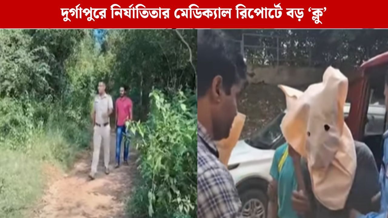 Durgapur Physical Assault: যৌনাঙ্গের ভিতরের অংশে গভীর ক্ষত, হয় প্রবল রক্তপাতও, দুর্গাপুরের নির্যাতিতার মেডিক্যাল রিপোর্টে ধর্ষণের ইঙ্গিত