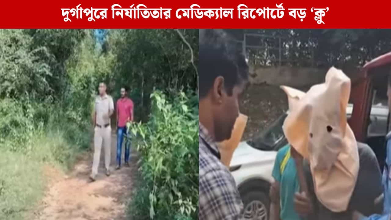 Durgapur Physical Assault: যৌনাঙ্গের ভিতরের অংশে গভীর ক্ষত, হয় প্রবল রক্তপাতও, দুর্গাপুরের নির্যাতিতার মেডিক্যাল রিপোর্টে ধর্ষণের ইঙ্গিত Durgapur Physical Assault: যৌনাঙ্গের ভিতরের অংশে গভীর ক্ষত, হয় প্রবল রক্তপাতও, দুর্গাপুরের নির্যাতিতার মেডিক্যাল রিপোর্টে ধর্ষণের ইঙ্গিত