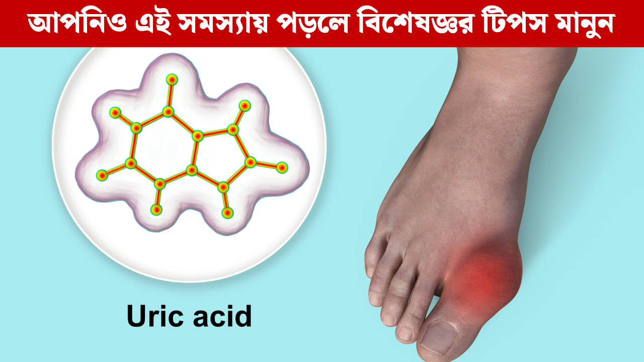 Uric Acid: ইউরিক অ্যাসিডের মাত্রা ঘন ঘন বৃদ্ধি পাচ্ছে? বিশেষজ্ঞদের থেকে জানুন কীভাবে নিয়ন্ত্রণ করবেন