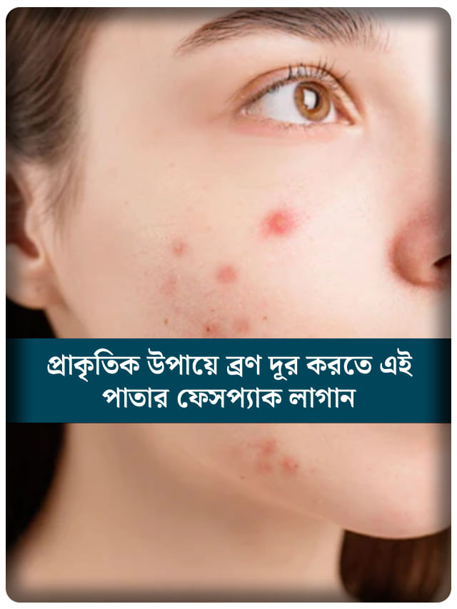 ব্রণমুক্ত উজ্জ্বল ত্বক পেতে কাজে লাগান ভেষজ পাতার জাদু