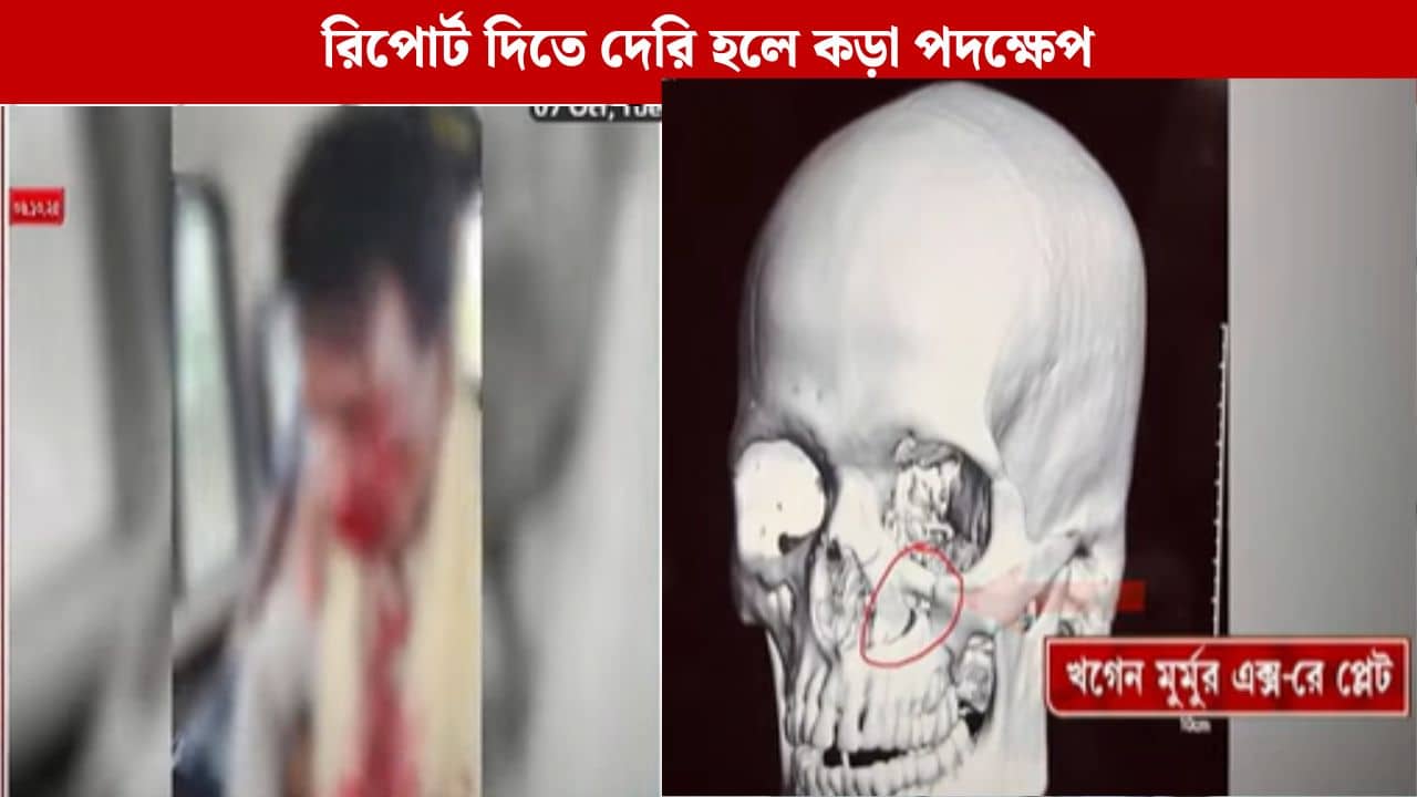 Attacked On BJP: খগেন মুর্মুর ওপর হামলা, এবার রাজ্যের কাছে রিপোর্ট তলব লোকসভার স্পিকারের