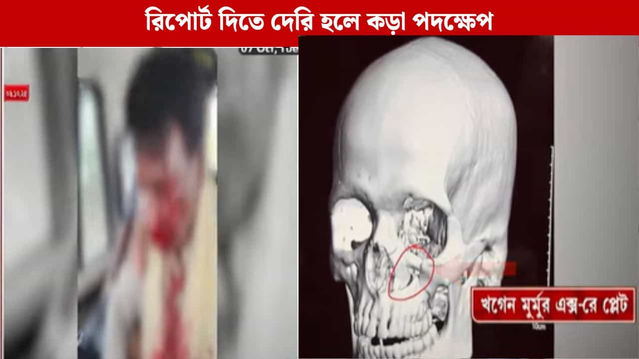 Attacked On BJP: খগেন মুর্মুর ওপর হামলা, এবার রাজ্যের কাছে রিপোর্ট তলব লোকসভার স্পিকারের Attacked On BJP: খগেন মুর্মুর ওপর হামলা, এবার রাজ্যের কাছে রিপোর্ট তলব লোকসভার স্পিকারের