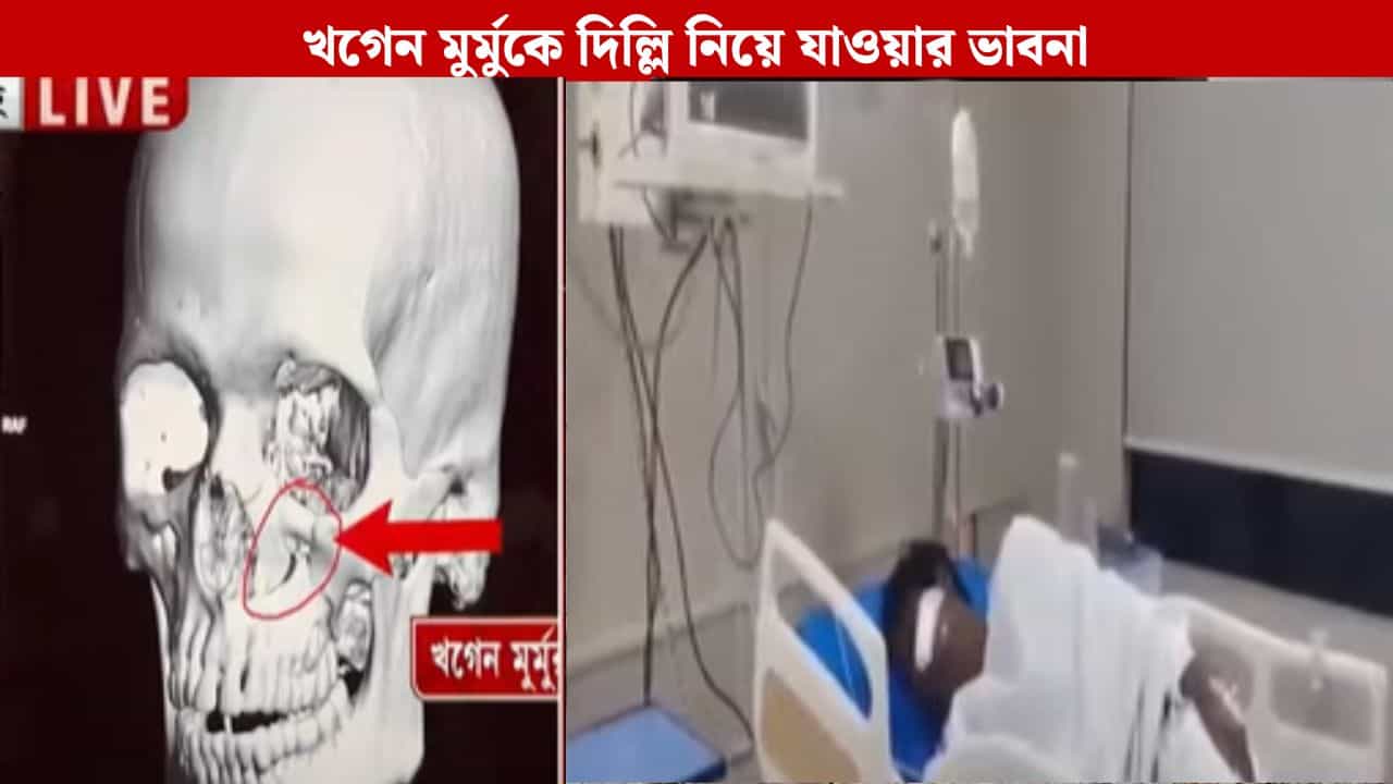 Attacked On Khagen Murmu: মুখে বসানো হতে পারে পাত, আপাতত কথা বলতে পারবেন না খগেন মুর্মু, দিল্লি নিয়ে যাওয়ার ভাবনা পরিবারের Attacked On Khagen Murmu: মুখে বসানো হতে পারে পাত, আপাতত কথা বলতে পারবেন না খগেন মুর্মু, দিল্লি নিয়ে যাওয়ার ভাবনা পরিবারের