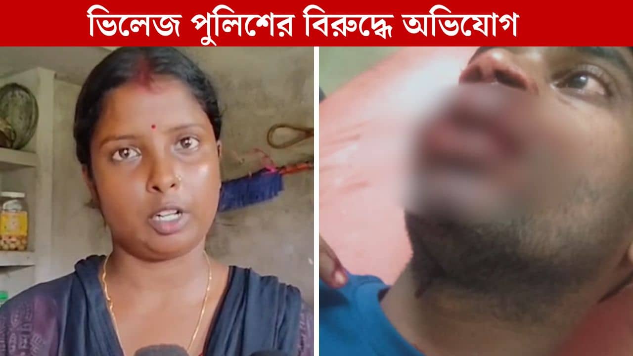 Margram Bomb: দশমীর সন্ধ্যায় যুবকের মুখে ছোড়া হল বোমা! চাঞ্চল্য মাড়গ্রামে