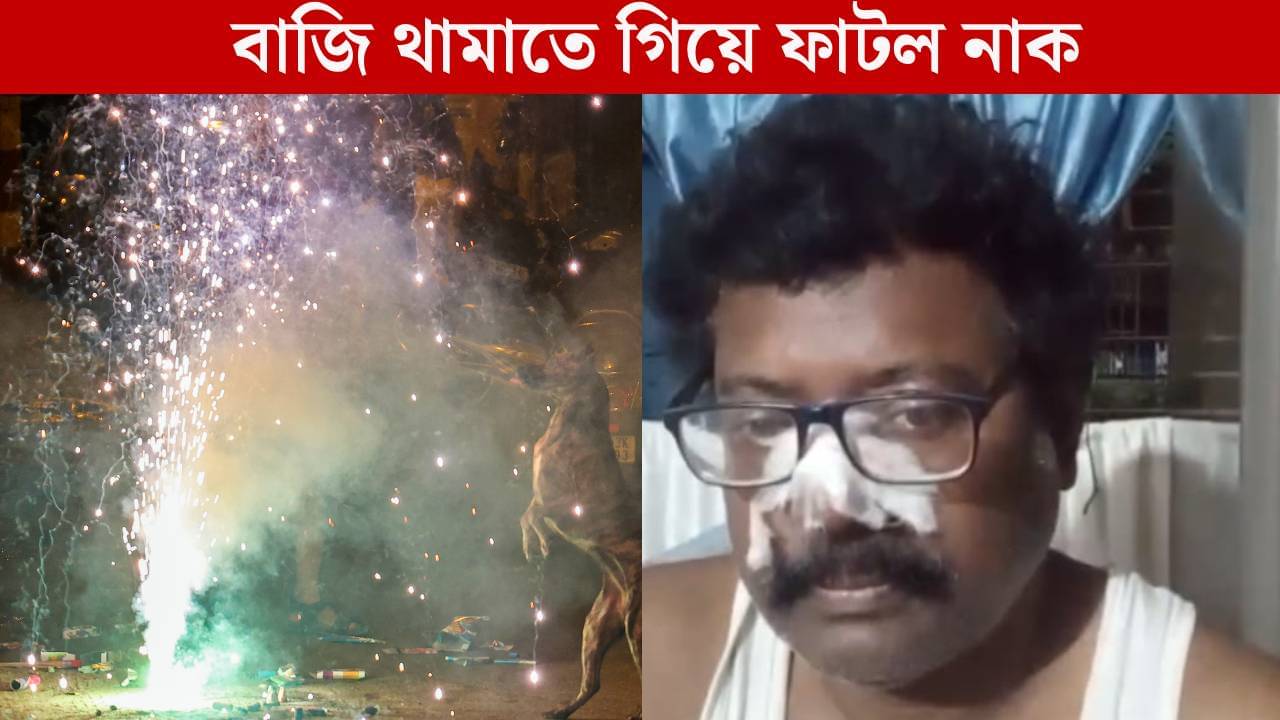 Kalipuja: তারস্বরে মাইক-ডিজে থামাতে বলতেই এমন মার! ফেটে গেল নাক