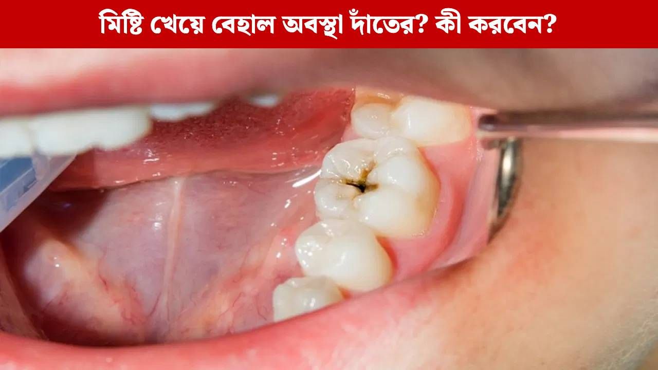 Mouth Health: বিজয়ায় মিষ্টি খেয়ে কিন্তু বারোটা বাজছে আপনার দাঁতের! কীভাবে তার খেয়াল রাখবেন?
