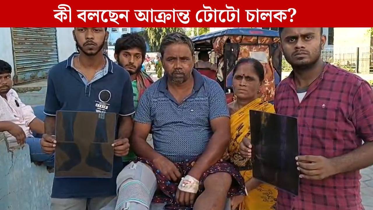 Malda: সিভিক ভলান্টিয়ারের দাদাগিরি, হাজার টাকা না দেওয়ায় মেরে পা ভাঙল টোটো চালকের