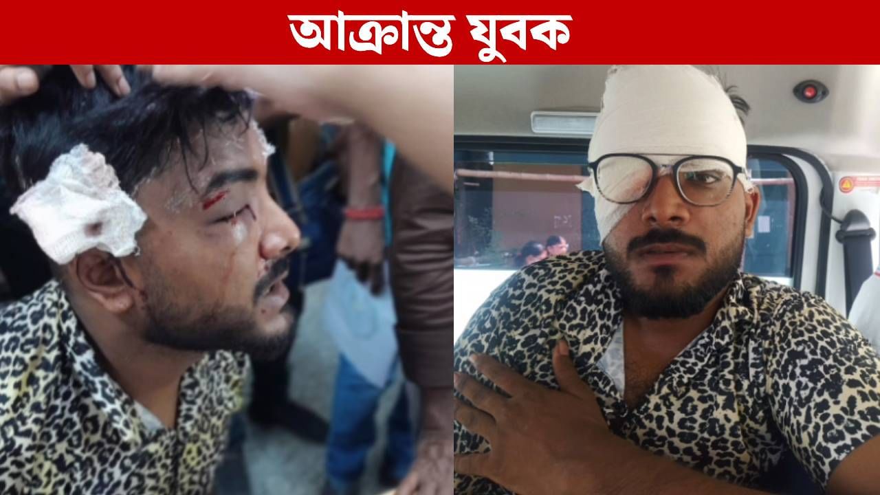 Serampore Couple News: গভীর রাতে প্রেমিকার সঙ্গে একান্ত সাক্ষাৎ, বাবা-ভাইয়ের হাতে মার খেয়ে হাসপাতালে যুবক Serampore Couple News: গভীর রাতে প্রেমিকার সঙ্গে একান্ত সাক্ষাৎ, বাবা-ভাইয়ের হাতে মার খেয়ে হাসপাতালে যুবক