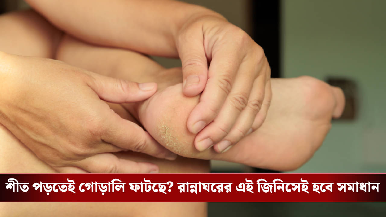 Cracked Heels Care: ফাটা গোড়ালির ব্যথায় কাবু? বিদায় জানান যন্ত্রণাকে, কাজে লাগান এই ঘরোয়া টোটকা