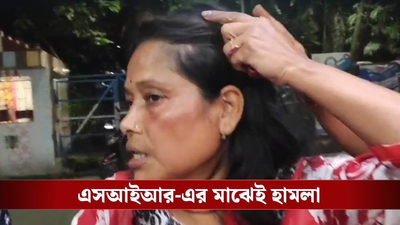 BLO: রাস্তায় মাথা ঠুকে, হাত মুচড়ে, চুলে মুঠি ধরে মার, এসএসকেএমে ভর্তি বিএলএ BLO: রাস্তায় মাথা ঠুকে, হাত মুচড়ে, চুলে মুঠি ধরে মার, এসএসকেএমে ভর্তি বিএলএ