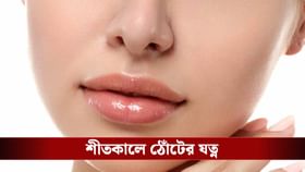ঘন ঘন ঠোঁট শুকিয়ে যাচ্ছে? ঘরোয়া উপায়ে দূর করুন সমস্যা