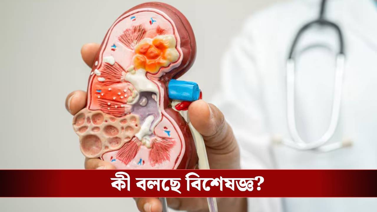 বার বার টয়লেটে যেতে হয়? আপনার কিডনি ঠিক আছে তো!
