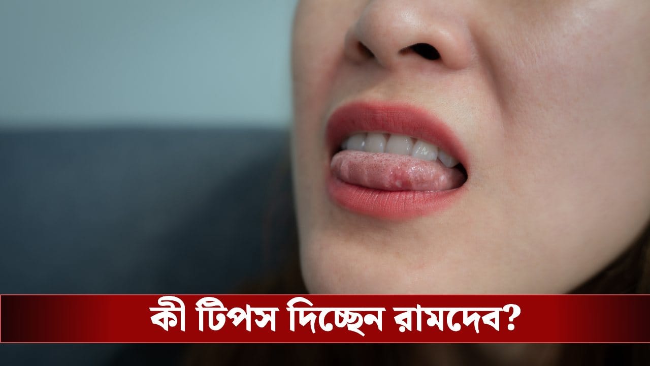 রামদেব: আলসার থেকে মুক্তি দরকার? রামদেবের এই কথাগুলো শুনুন রামদেব: আলসার থেকে মুক্তি দরকার? রামদেবের এই কথাগুলো শুনুন